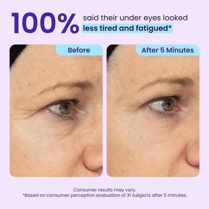 Orvyron® Eye Bag Instant Eraser, Tightens, Firms & Blurs Wrinkles