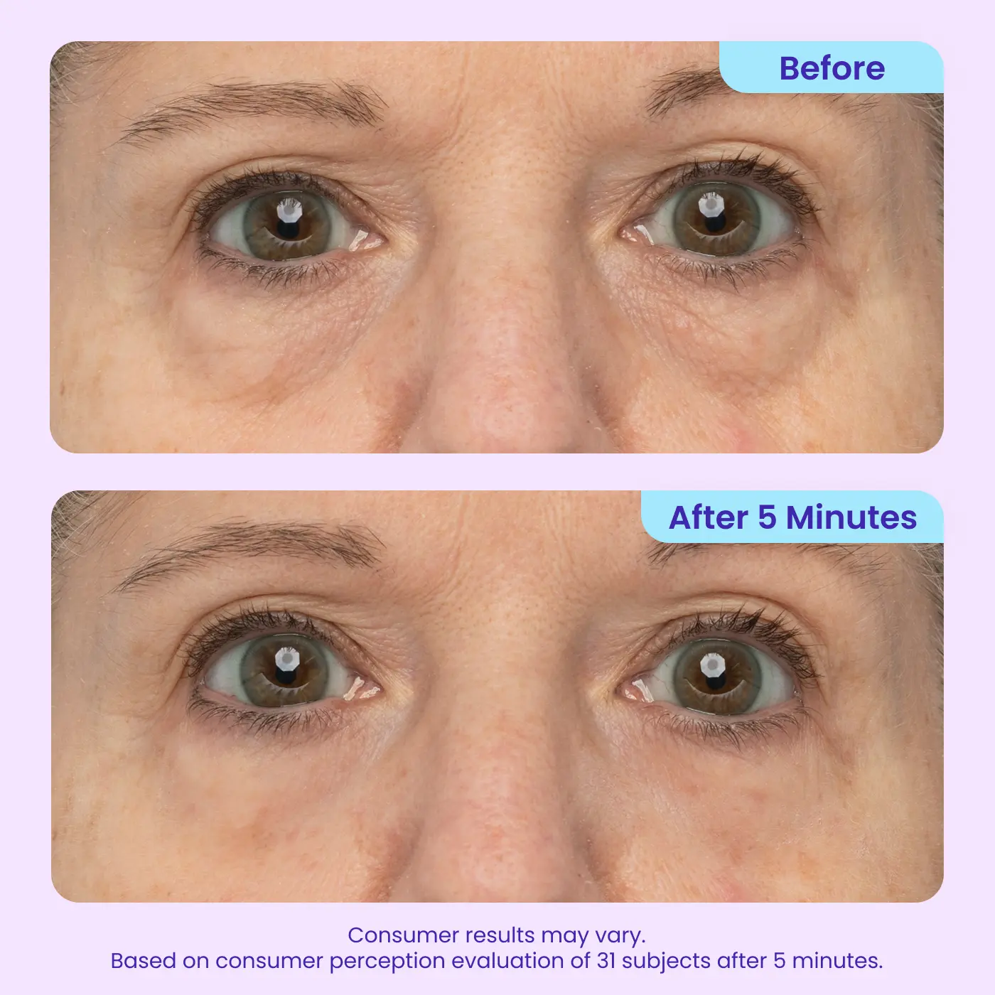 Orvyron® Eye Bag Instant Eraser, Tightens, Firms & Blurs Wrinkles