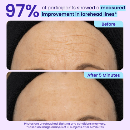 Orvyron® Eye Bag Instant Eraser, Tightens, Firms & Blurs Wrinkles