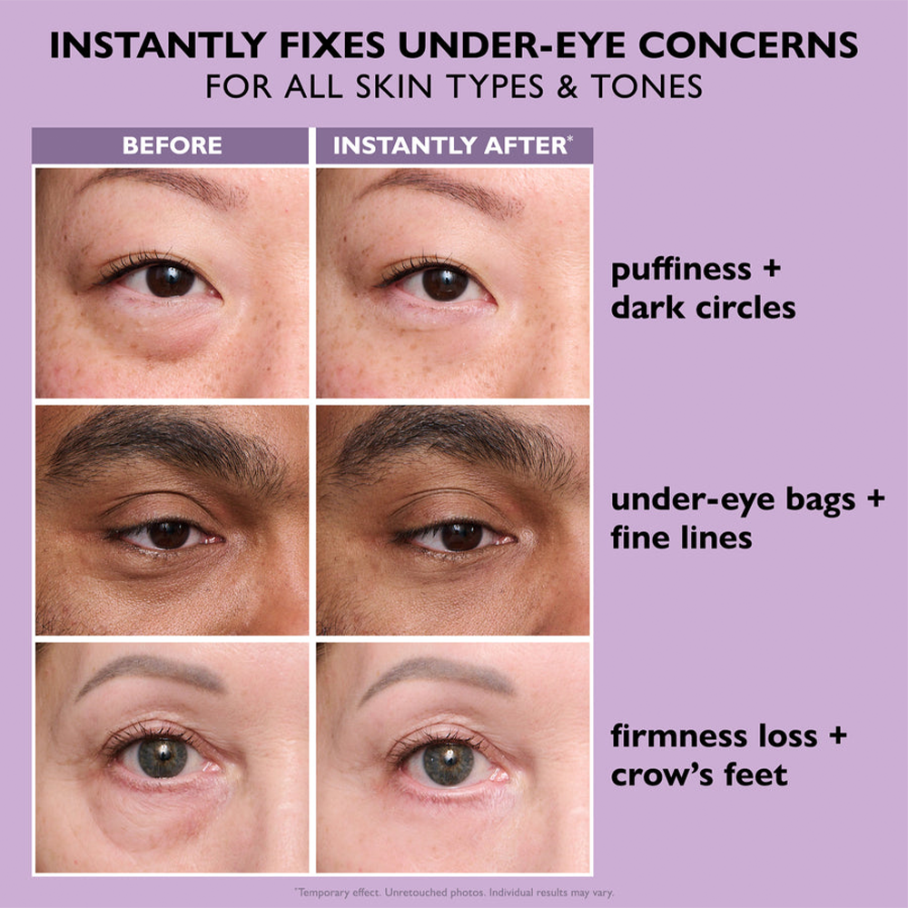 Orvyron® Eye Bag Instant Eraser, Tightens, Firms & Blurs Wrinkles