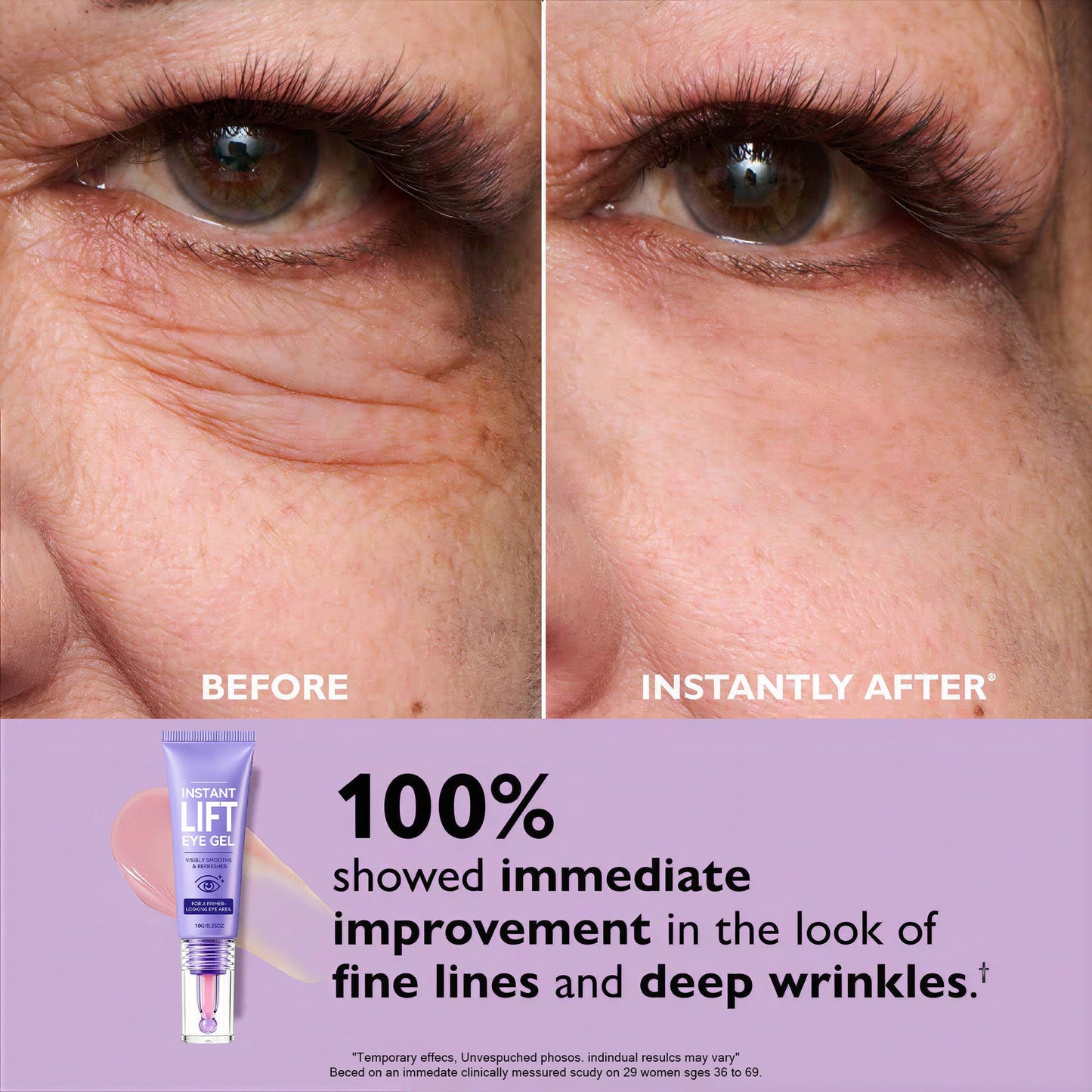Orvyron® Eye Bag Instant Eraser, Tightens, Firms & Blurs Wrinkles